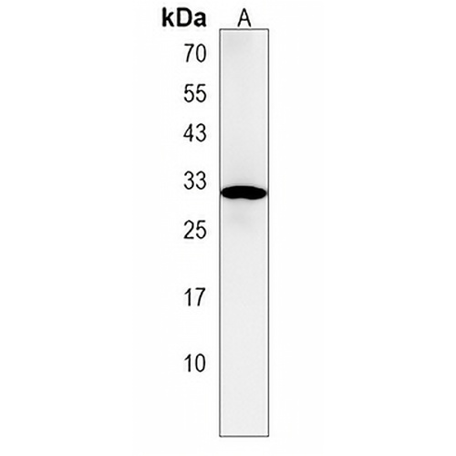 DDO Rabbit Polyclonal Antibody
