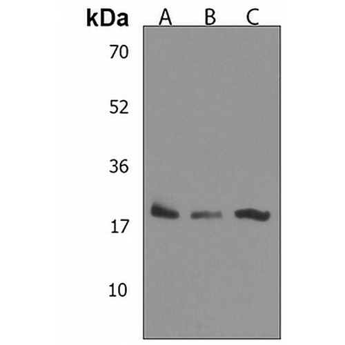 Epiregulin Rabbit Polyclonal Antibody