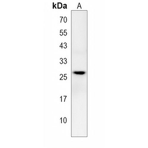ZCCHC24 Rabbit Polyclonal Antibody