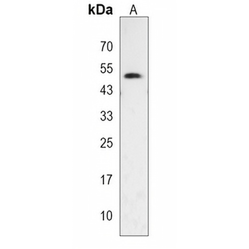 GSDMA Rabbit Polyclonal Antibody