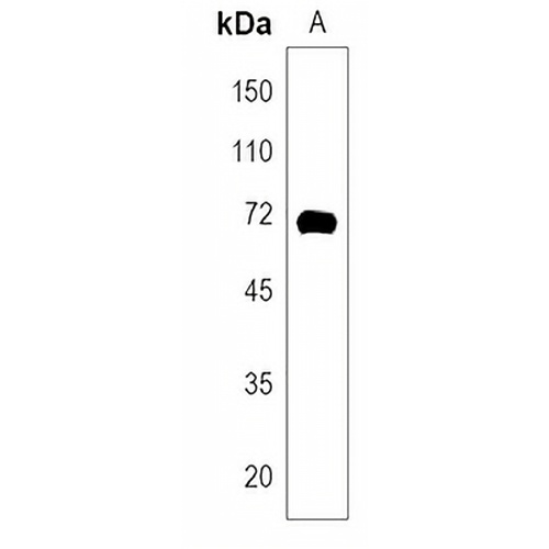 WDTC1 Rabbit Polyclonal Antibody