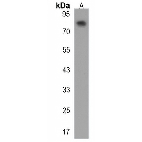 PAN3 Rabbit Polyclonal Antibody