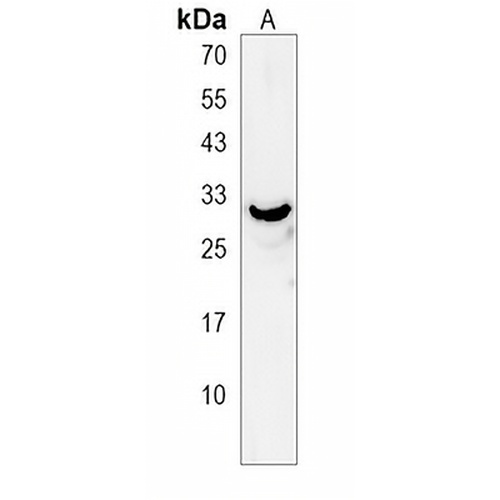 ANKRD49 Rabbit Polyclonal Antibody