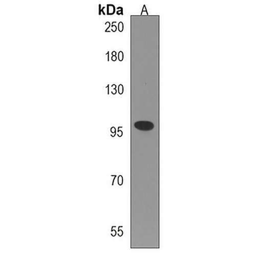 TTI1 Rabbit Polyclonal Antibody