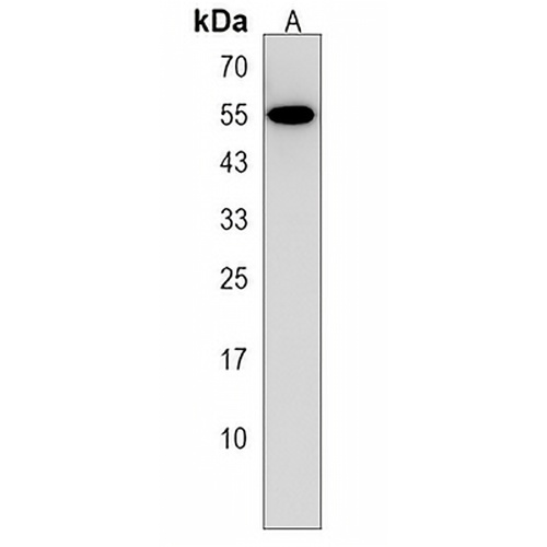 POTEH Rabbit Polyclonal Antibody