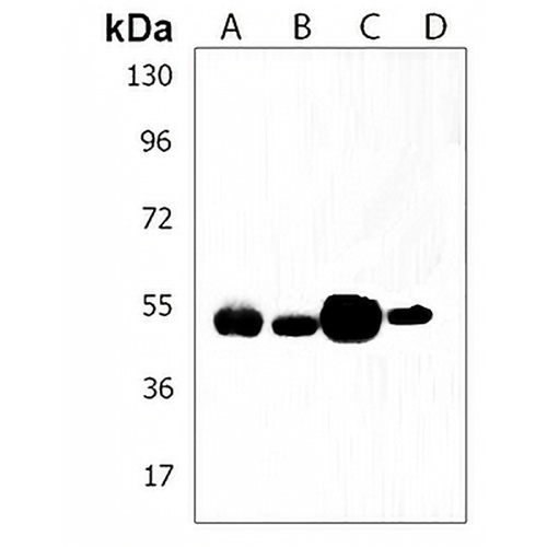 TUBB4B Rabbit Polyclonal Antibody