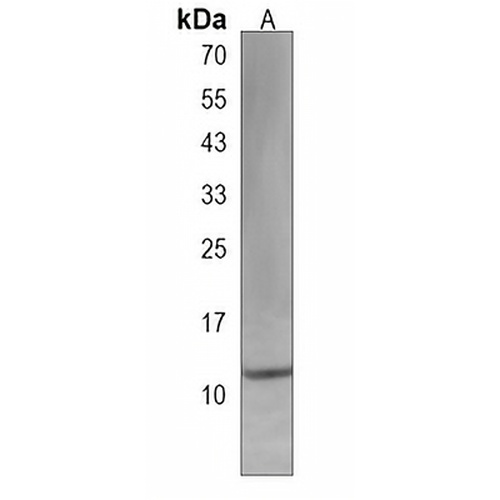 IFT20 Rabbit Polyclonal Antibody