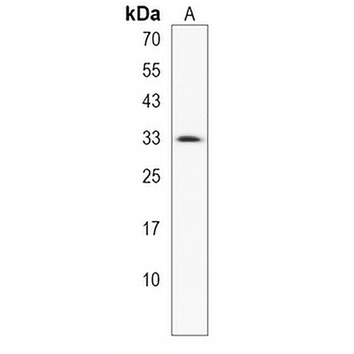 CCDC101 Rabbit Polyclonal Antibody