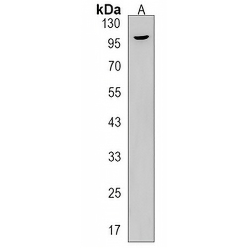 ACAP3 Rabbit Polyclonal Antibody