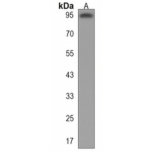 EPC2 Rabbit Polyclonal Antibody