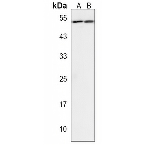 HAUS4 Rabbit Polyclonal Antibody