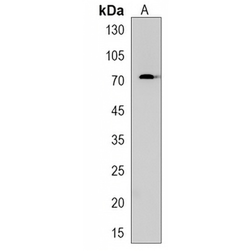 HAUS5 Rabbit Polyclonal Antibody