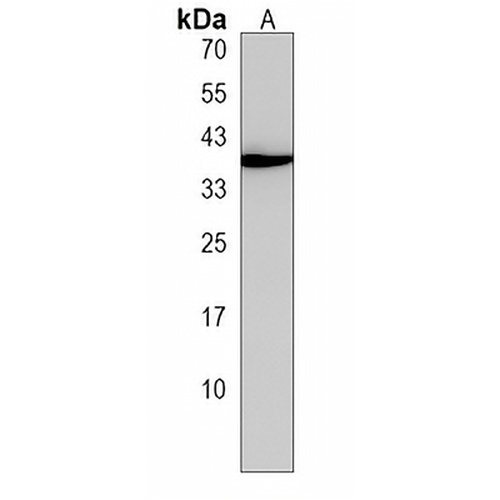 SLC25A28 Rabbit Polyclonal Antibody