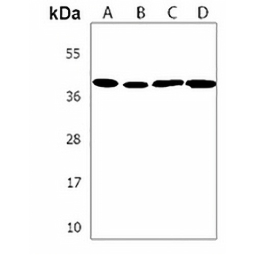 SRD5A3 Rabbit Polyclonal Antibody