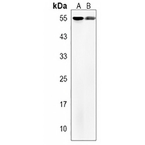 TMEM87B Rabbit Polyclonal Antibody