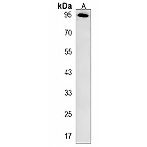 ARMC5 Rabbit Polyclonal Antibody