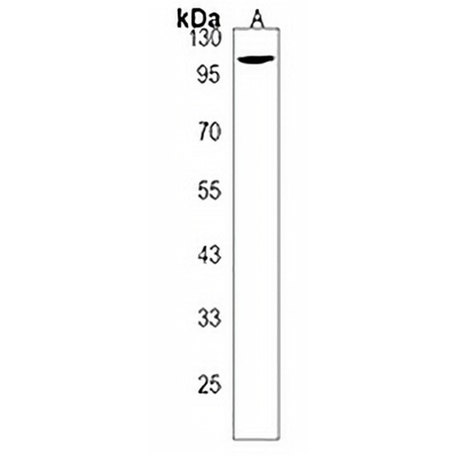 CCDC146 Rabbit Polyclonal Antibody