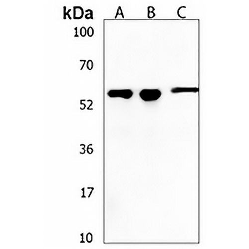 KLHL20 Rabbit Polyclonal Antibody
