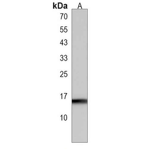 map1lc3a Rabbit Polyclonal Antibody