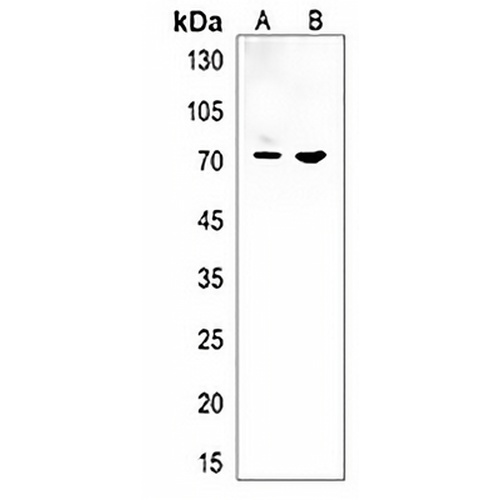 mtmr14 Rabbit Polyclonal Antibody