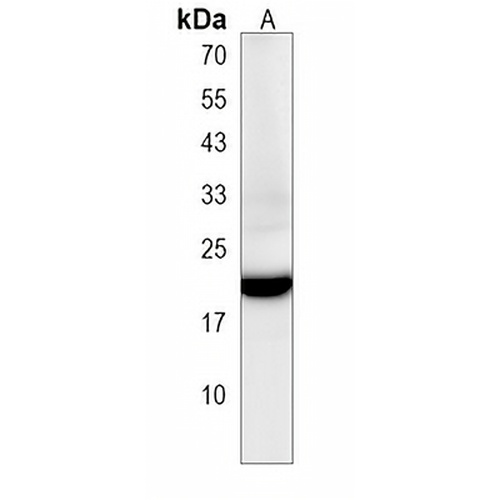 tmem208 Rabbit Polyclonal Antibody