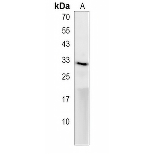 ak2 Rabbit Polyclonal Antibody