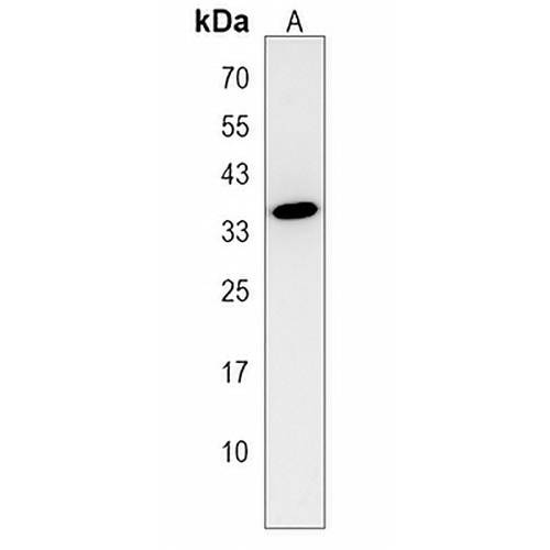 clvs2 Rabbit Polyclonal Antibody