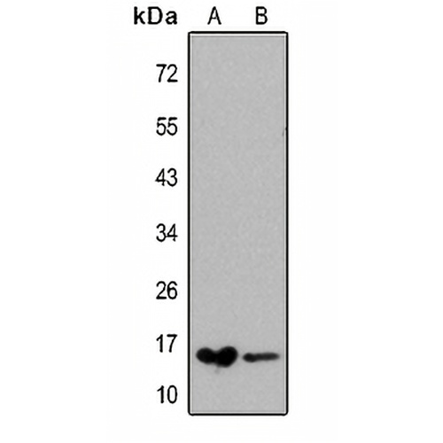FABP1 Rabbit Polyclonal Antibody