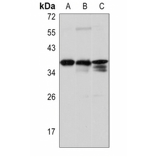 TMX2 Rabbit Polyclonal Antibody