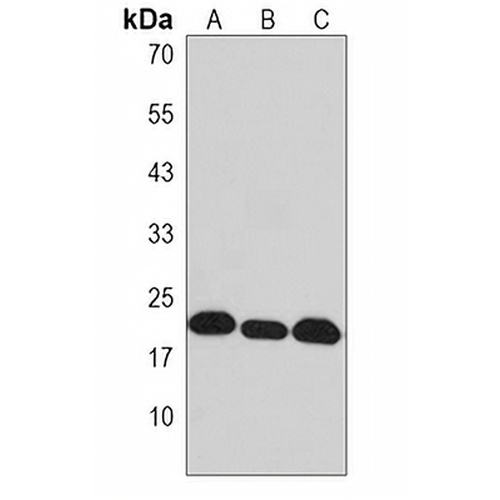 NDUFB8 Rabbit Polyclonal Antibody