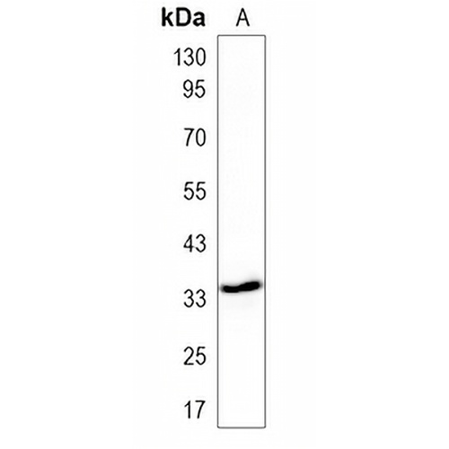Pim-1 Rabbit Polyclonal Antibody