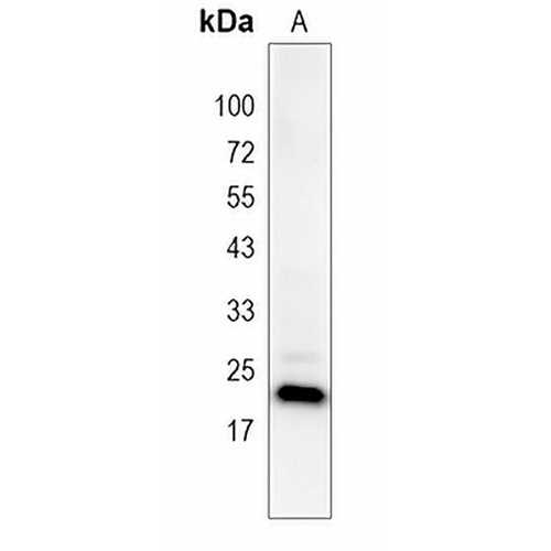 TSPAN13 Rabbit Polyclonal Antibody