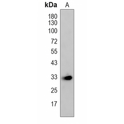 RNASEH2A Rabbit Polyclonal Antibody