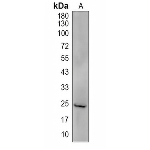 TMEM86B Rabbit Polyclonal Antibody