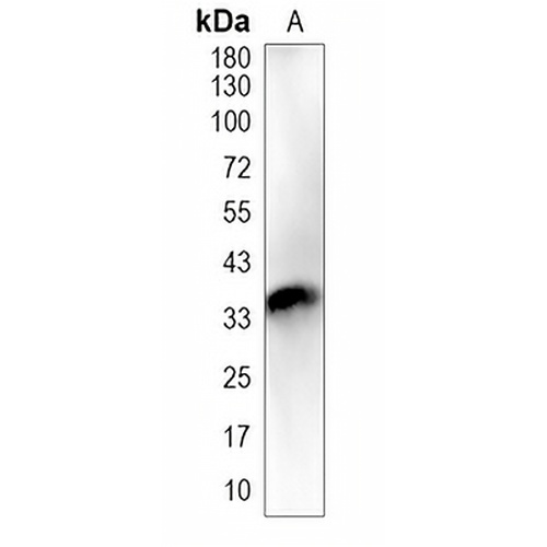 ALX1 Rabbit Polyclonal Antibody