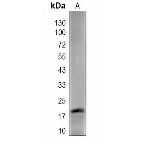 MT-ND6 Rabbit Polyclonal Antibody