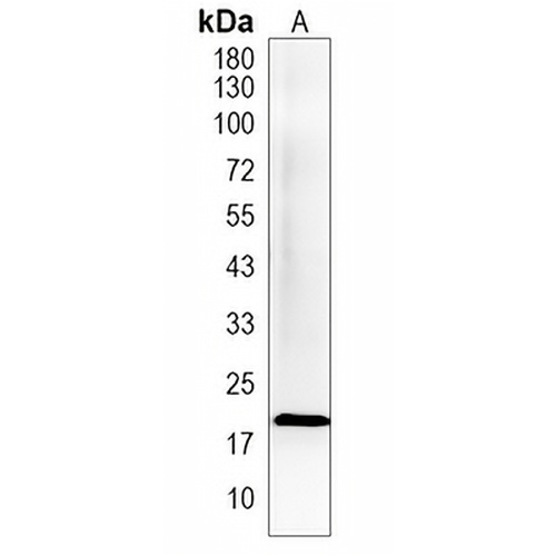 TMEM238 Rabbit Polyclonal Antibody