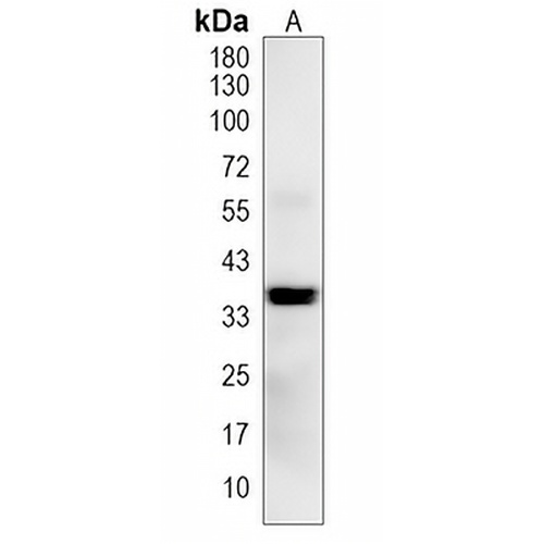 ST3GAL1 Rabbit Polyclonal Antibody