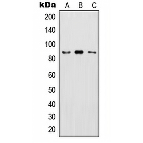 IKK beta (Phospho-Y199) Rabbit Polyclonal Antibody