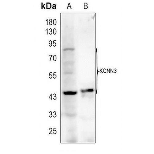 KCNN3 Rabbit Polyclonal Antibody