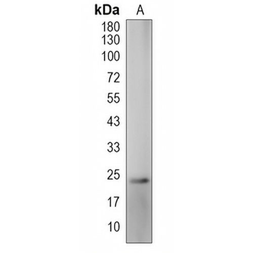 ARL4A Rabbit Polyclonal Antibody