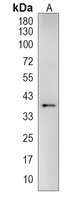 XCR1 Rabbit Polyclonal Antibody