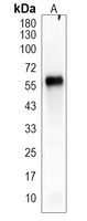 TRIM65 Rabbit Polyclonal Antibody